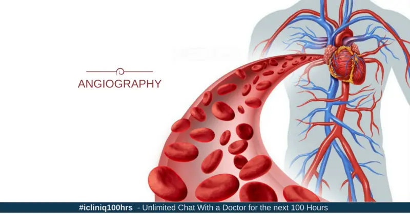 Image:Role of Angiography in Modern Era Image: Role of Angiography in Modern Era